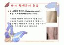 하지정맥류 질환 정리 11페이지