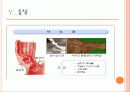 식도암(Esophageal cancer) 8페이지