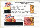 심근경색증 6페이지