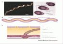 Lyme disease 4페이지