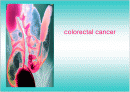 대장암 (colon cancer) & 간호과정 1페이지