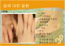 발에대한질병 8페이지