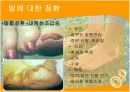 발에대한질병 9페이지