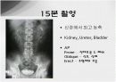 [방사선] 투시조영에서의 경정맥 요로 조영 검사 (IVP) 7페이지