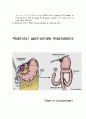 subtotal gastrectomy 11페이지
