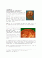 신경화증(nephrosclerosis) 2페이지