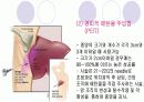 HCC 간암 (hepatic cell carcinoma) 17페이지