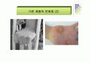 (PPT 발표자료)창업 아이템- 의료기기 8페이지