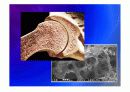Biomechanic of bone 13페이지