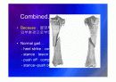 Biomechanic of bone 26페이지