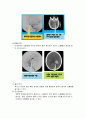 최근 우리나라에서는 허혈성 심장질환과 뇌졸중 환자가 계속하여 증가하는 추세이다. 뇌졸중과의 허혈성 심장질환발생현황과 증상 및 식사요법에 대하여 제시하시오. 각종 보건통계 및 병원의 처방 식단, 전문 웹사 15페이지