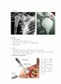 shouler op(rotator cuff tear, SLAP, bankart lesion) 3페이지