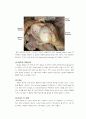 shouler op(rotator cuff tear, SLAP, bankart lesion) 7페이지