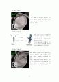 shouler op(rotator cuff tear, SLAP, bankart lesion) 8페이지
