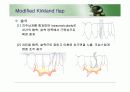 치주판막술식(periodontal flap) 17페이지
