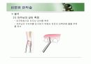 치주판막술식(periodontal flap) 29페이지