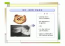 장중첩증 케이스스터디  8페이지