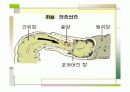 장중첩증 케이스스터디  11페이지