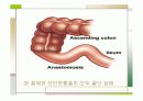 장중첩증 케이스스터디  21페이지