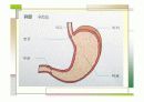 특발성비후성유문협착증 4페이지
