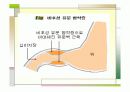 특발성비후성유문협착증 5페이지