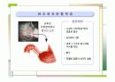 특발성비후성유문협착증 8페이지