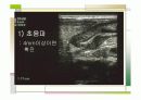 특발성비후성유문협착증 11페이지