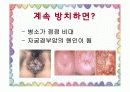 전염성 콘딜로마 ppt 자료 11페이지