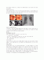 비소세포암(NSCLCa) 케이스 스터디(CASE STUDY) 4페이지