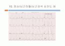 운동부하검사 29페이지