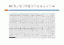 운동부하검사 33페이지