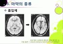 [마약]마약의 정의와 종류, 마약의 위험성과 부작용, 남용 시 문제점을 알아보고, 마약 복용 실태 조사 및 예방, 퇴치를 위한 노력 소개 23페이지