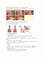 자연기흉, VATH(비디오 흉강경 수술) 9페이지