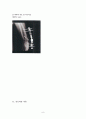 Lt. distal radius fx 8페이지
