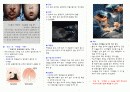토순과 구개열 부모교육 자료 리플렛  1페이지