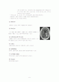 성인간호학 실습 case study 뇌내출혈 ICH(Intracerebral hemorrhage) 6페이지