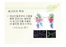 혈우병ppt 14페이지