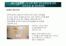 인공항문 43페이지