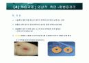 인공항문 50페이지