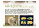뇌졸중의 모든것(원인 증상 진단 치료 etc.) 40페이지