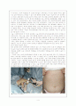  Gastric ca. 위암 케이스 4페이지