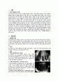 자궁근종(Leiomyoma of uterus) 2페이지