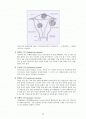 성인간호 자궁근종 정리 2페이지