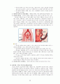 성인간호 자궁근종 정리 8페이지