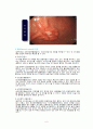 case study - Stomach Cancer (케이스 스터디 - 위암) 6페이지