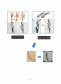 Case Study - 뇌경색 15페이지