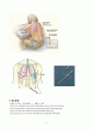 흉곽천자(Thoracentesis) 5페이지