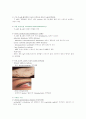 면역결핍 - 알레르기, 면역결핍증, 과민반응, 자가면역증 11페이지