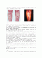 아동간호/  ITP대상자 사례연구 (Case Study) 3페이지