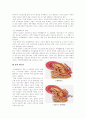 [모성간호]유도분만(NSVD) case study 3페이지